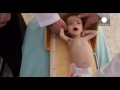 Syria: child malnutrition now “serious” – UNICEF