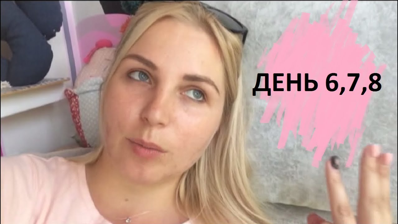 Въехали в машину