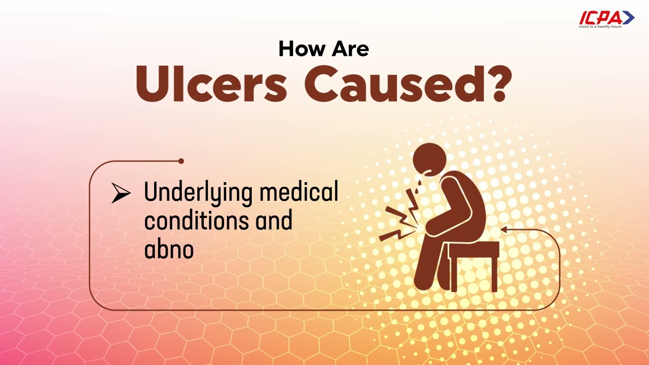 Trioplast - The Best Treatment for Inflamed Oral Ulcers