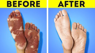 Take care of your feet with these hacks