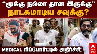 Savukku Shankar | ”மூக்கு நல்லா தான இருக்கு” நாடகமாடிய சவுக்கு? MEDICAL ரிப்போர்ட்டில் அதிர்ச்சி!