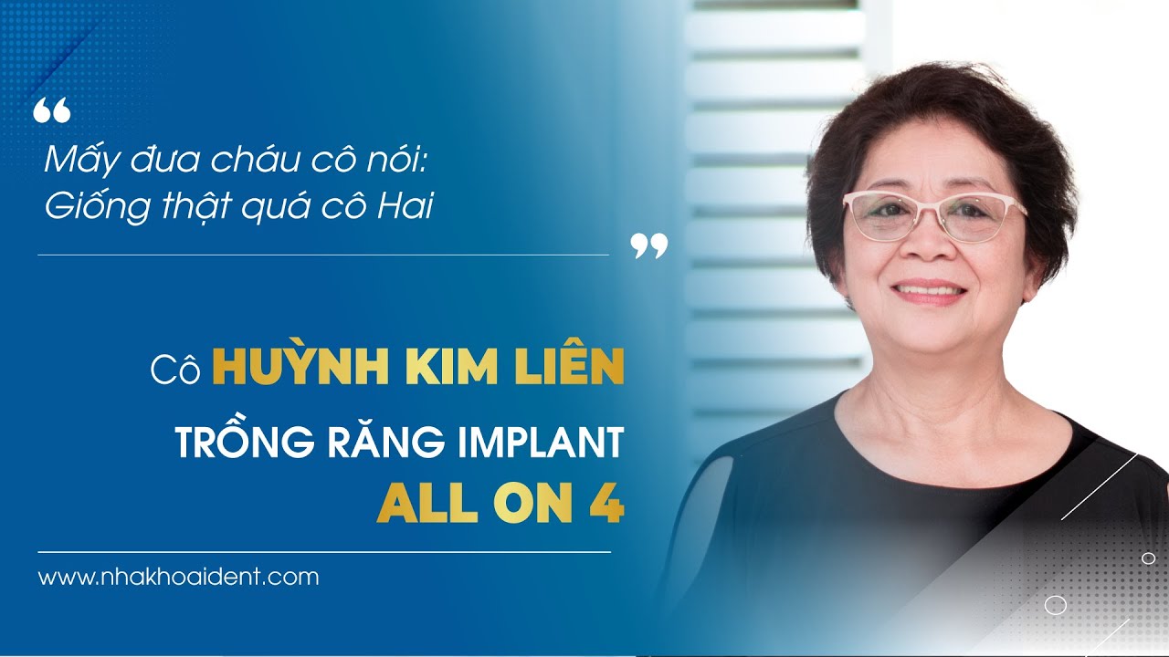 TRẢI NGHIỆM CẤY IMPLANT TOÀN HÀM ALL ON 4 STRAUMANN THỤY SỸ