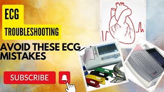 Avoid These ECG Mistakes: Expert Troubleshooting Tips