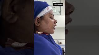 Bijaw surgery