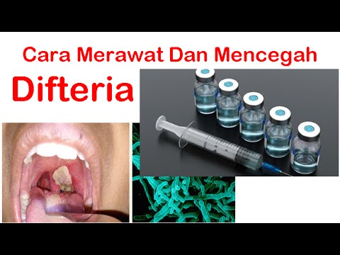 Video: Difteria - Penyebab, Gejala, Kaedah Rawatan, Pencegahan