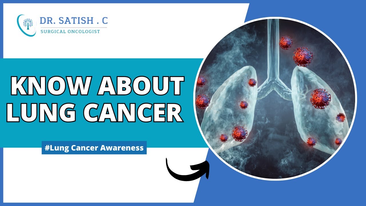Lung Cancer Awareness | Dr. Satish. C | Best Surgical Oncologist in Bangalore | Cancer Surgeon