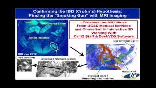 Larry Smarr - Quantifying The Dynamics of Your Superorganism Body Using Big Data Supercomputing