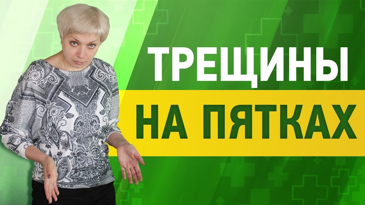 Как вылечить трещины на пятках домашними средствами - YouTube