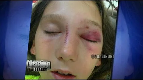 10-Year-Old Hit In Face With Foul Ball At Blue Cla...