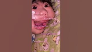 ANUGRAH TUMBUH GIGI🫢 #bayi #anugrah #anenchepaly