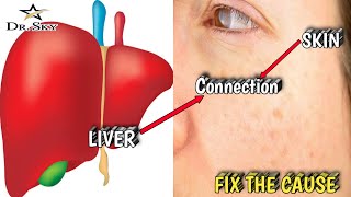 9- Signs of Toxin Build-up in the Liver llHindill ⚕️⚕️Dr.SKY⚕️⚕️