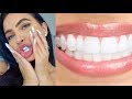 DIY REMOVE PLAQUE & TARTAR FROM TEETH AT HOME (100% WORKS) | How To NATURALLY Get Whitest Teeth Ever