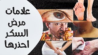 أعراض ارتفاع السكر في الدم عليك الإنتباه قبل فوات الاوان!!