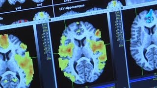 Investigating Drug Use: Brain Imaging