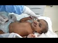 Calm Anesthesia for a cute Baby