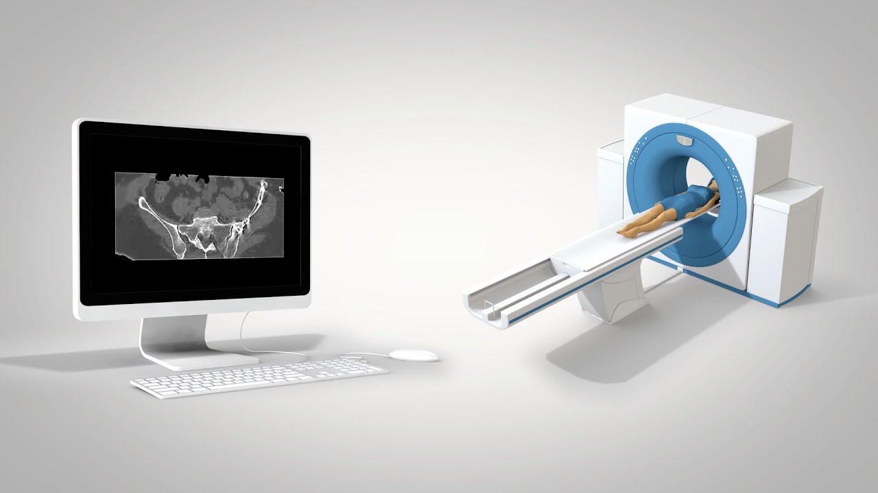 Produzione Video protesi in titanio trabecolato EBM