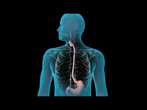 Endoscopia del Tracto Gastrointestinal Superior