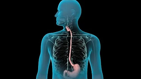 ¿Cómo se diagnostica una úlcera de estómago sin una endoscopia?