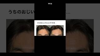 【クマ取り】これはすごい! #shorts
