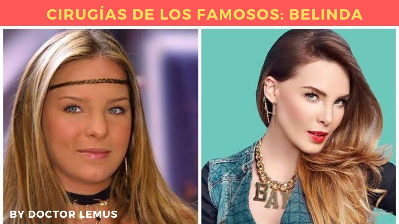 LAS 19 CIRUGÍAS PLÁSTICAS DE BELINDA 😱 DOCTOR LEMUS