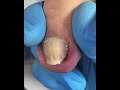 Gentle Toenail Trim | Relaxing Foot Care Routine #nails #footcare #pedicure