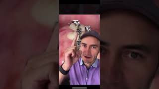 Así NUNCA se deben colocar los brackets. ¡Te pueden dañar mucho! #shorts