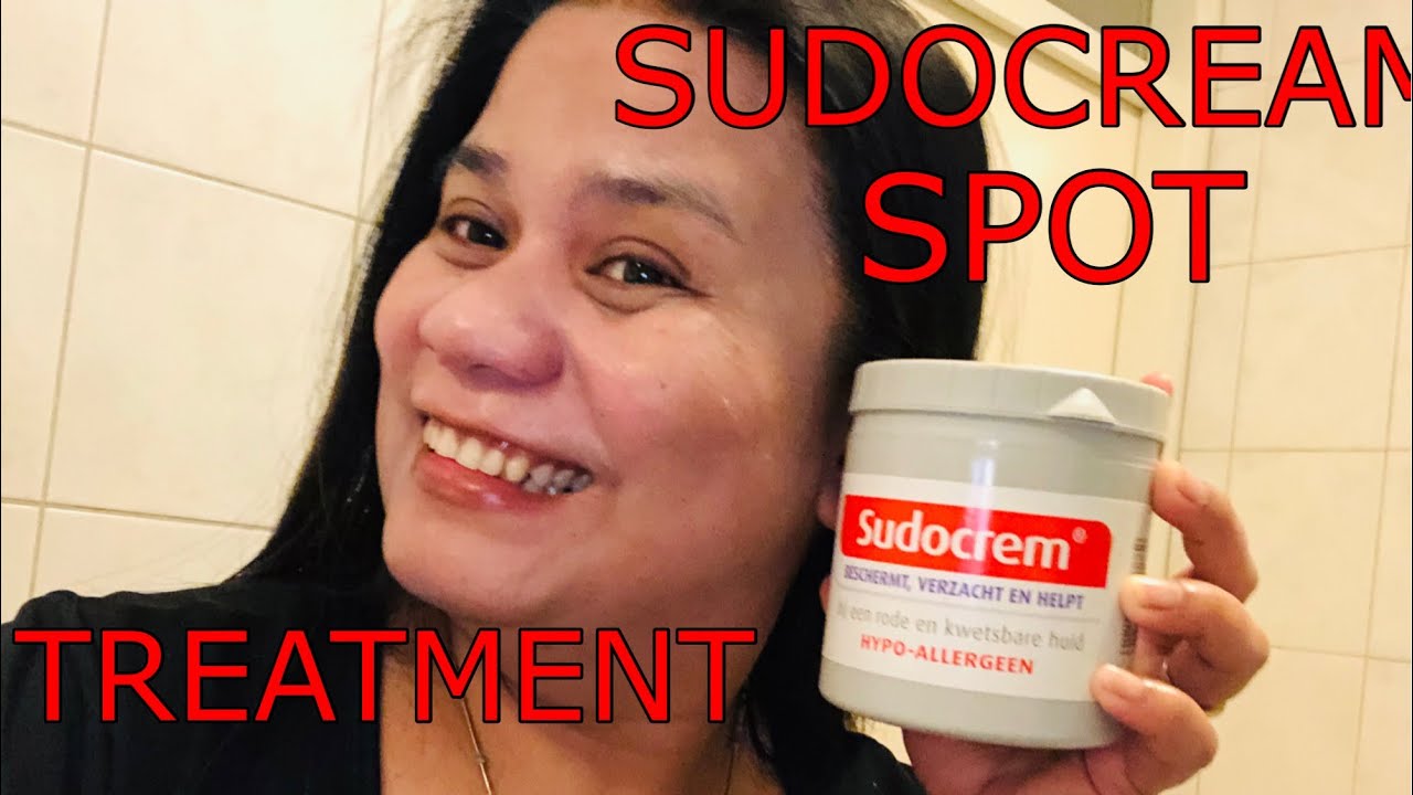 Handelshochschule Mars sudocrem mask for spots Etikette Berühmtheit Regierung Handelshochschule Mars sudocrem mask for spots Etikette Berühmtheit Regierung