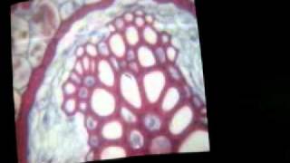 Dicot root -