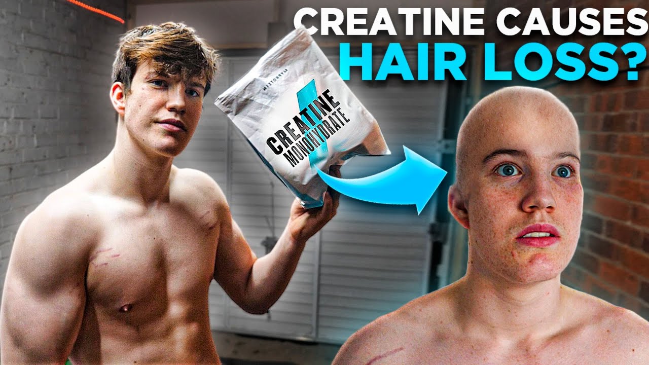 Does Creatine Cause Hair Loss? - thptnganamst.edu.vn