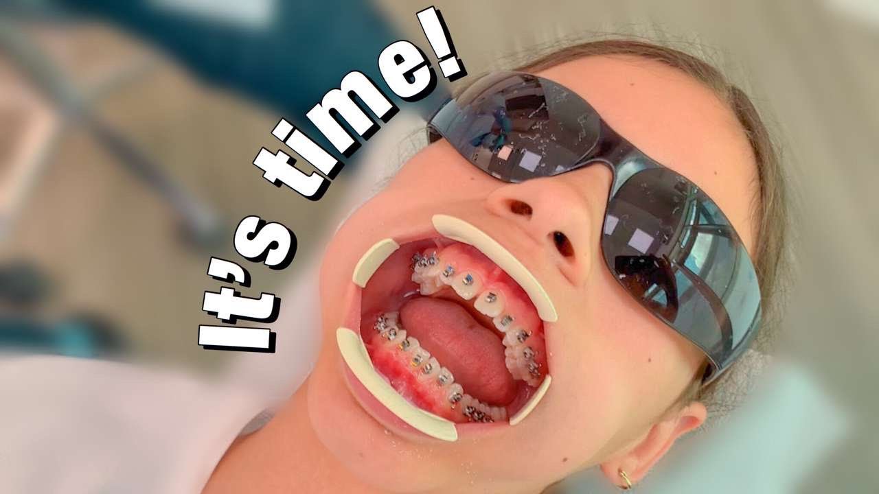 My first 24 HOURS with BRACES !! YouTube