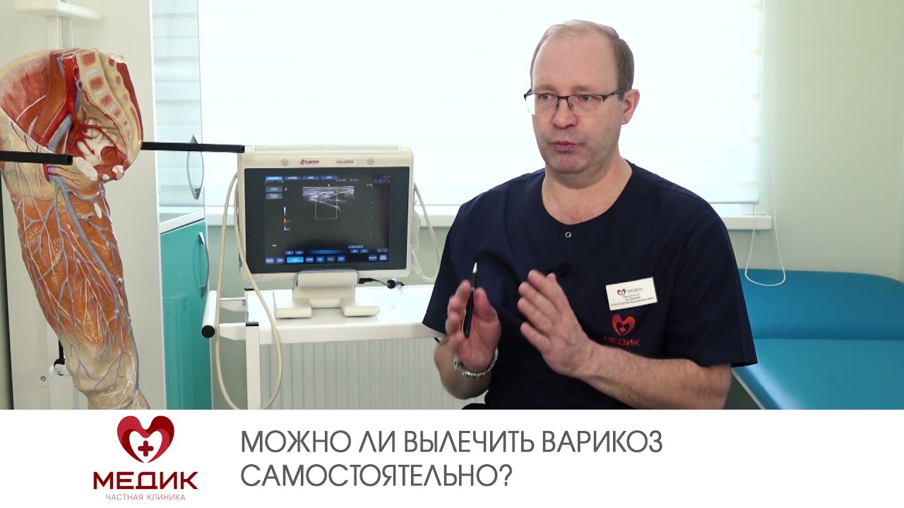 Можно ли вылечить варикоз самостоятельно? - YouTube