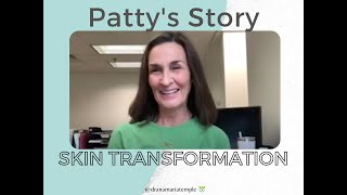 Skin Transformation Testimonial - Patty's Story | Dr. Ana-Maria Temple, Holistic Pediatrician