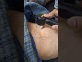 Ultrasound Therapy Ultrasound Therapy For Knee Pain Reduce Knee Pain Ultrasound Machine Dr Anup