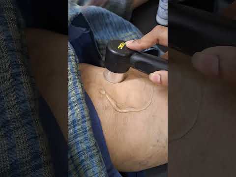 Ultrasound Therapy Ultrasound Therapy For Knee Pain Reduce Knee Pain Ultrasound Machine Dr Anup