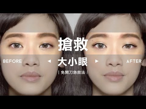 【凱咪急診室】免開刀的大小眼急救法
