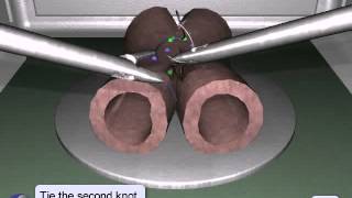LapSim Suturing & Anastomosis: Side to Side Anastomosis