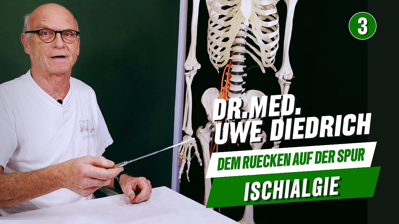 Rezensionen Für Herr Dr. Med. Uwe Barthold Dr.med. Uwe Diedrich - Ischialgie - YouTube