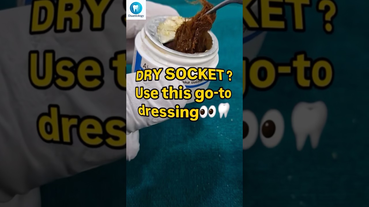 Watch How Dentists Kill Dry Socket Pain Fast! 🦷😱 #shorts on YouTube Watch How Dentists Kill Dry Socket Pain Fast! 🦷😱 #shorts on YouTube