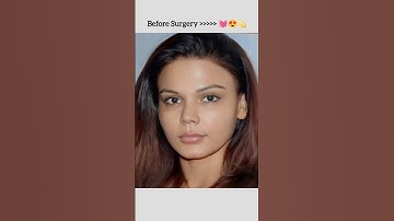 Rakhi Sawant Before Surgery 💓😍💫 #rakhisawant #status #trending #viral