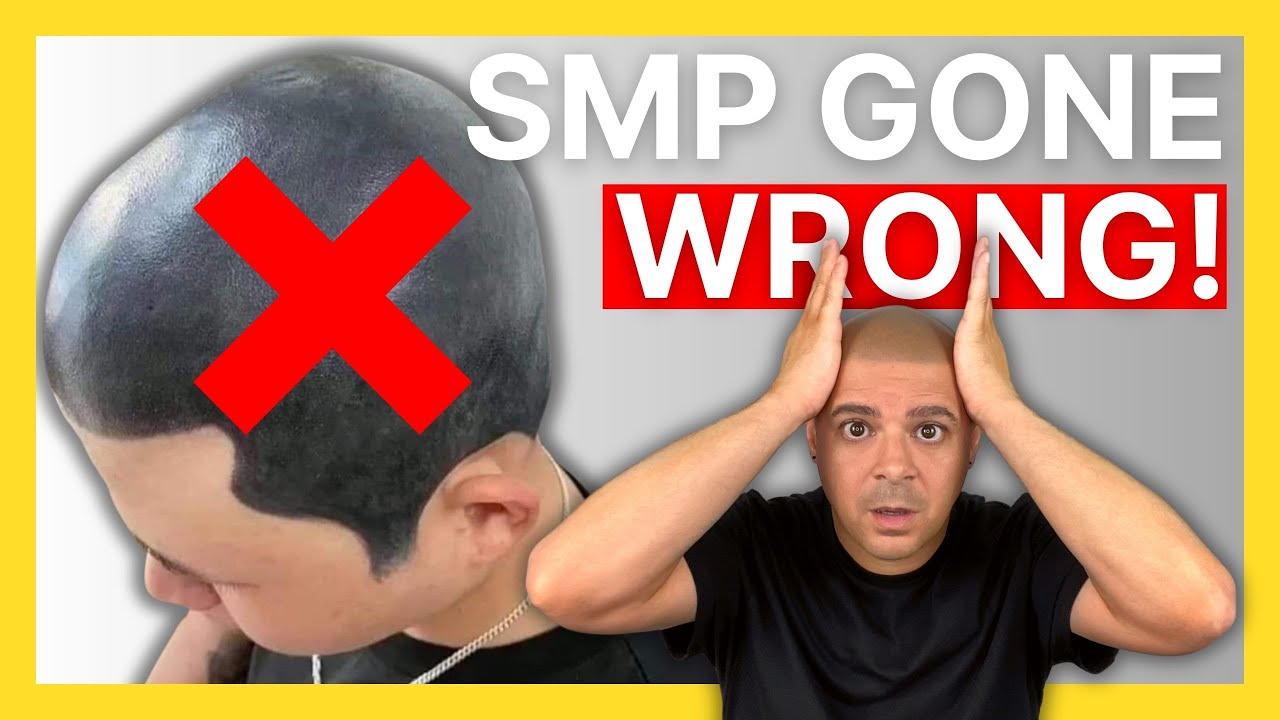 Scalp Micropigmentation GONE WRONG! | Avoid These Mistakes
