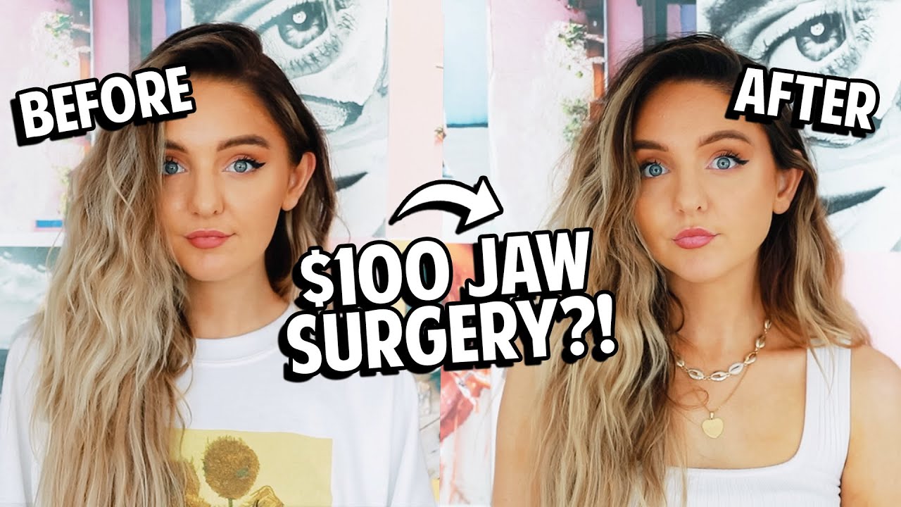 100 JAW SURGERY?! YouTube