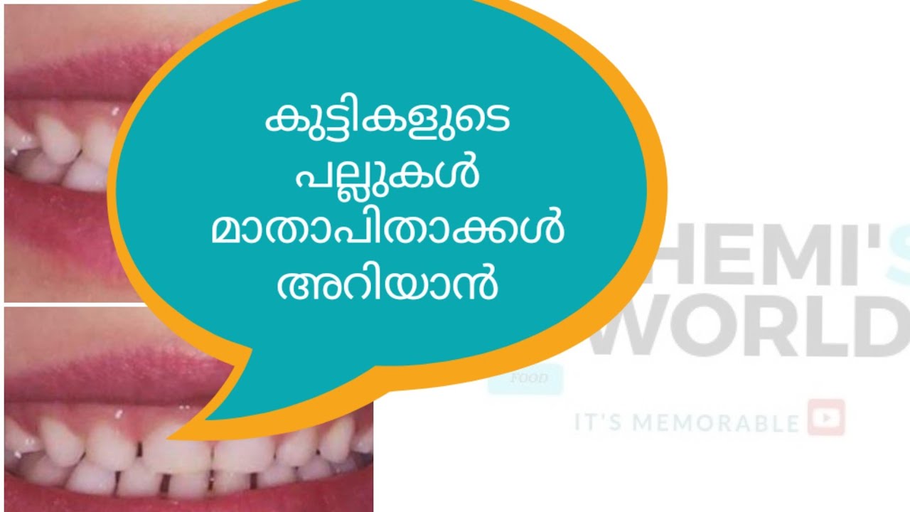 How to care children's teeth in malayalam.കുട്ടികളുടെ പല്ലുക