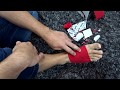 Morton's Neuroma Foot Pain Kinesio Taping | Northern Soul channel