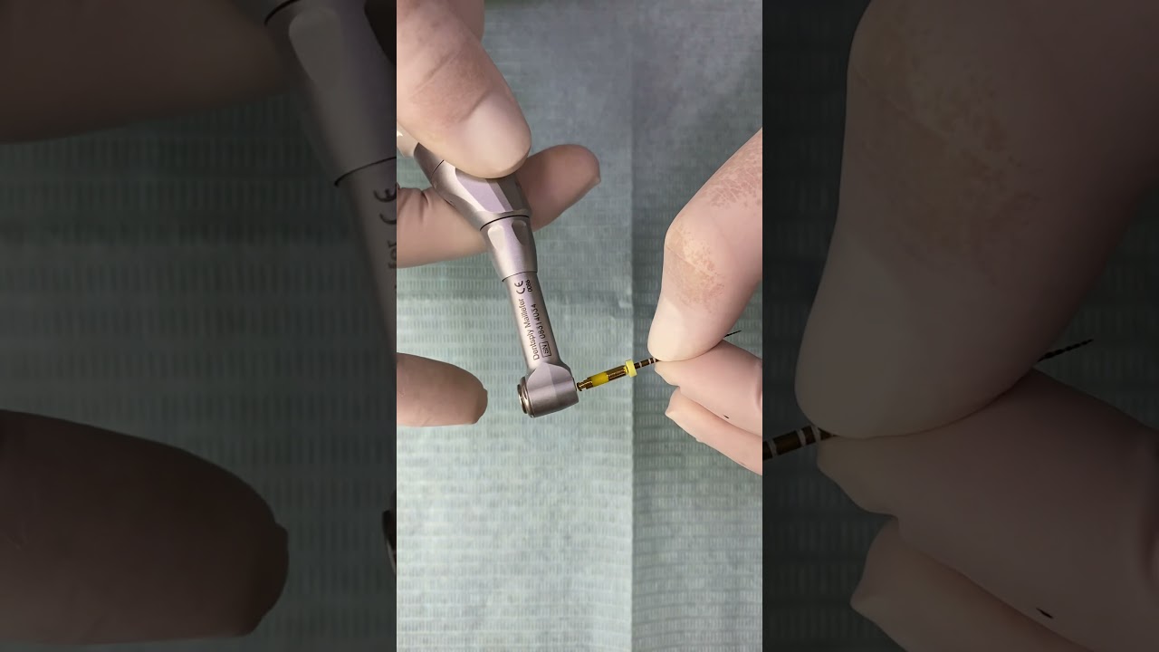 Protocolo Endodontia Mecanizada - UCPel