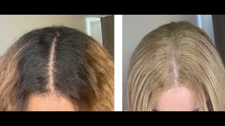 @BradMondo  DIYING MY HAIR FROM BLACK TO ASH BLONDE USING BOX DYE| كيف أصبغ أشقر فاتح بالبيت ?