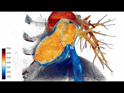 Cardiac volume renderer with clipping plane attach to camera - 4k 60fps