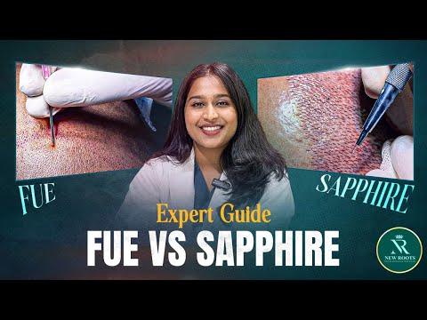 FUE vs Sapphire: What's the Difference? 🤔 | Hair Transplant Methods | New Roots
