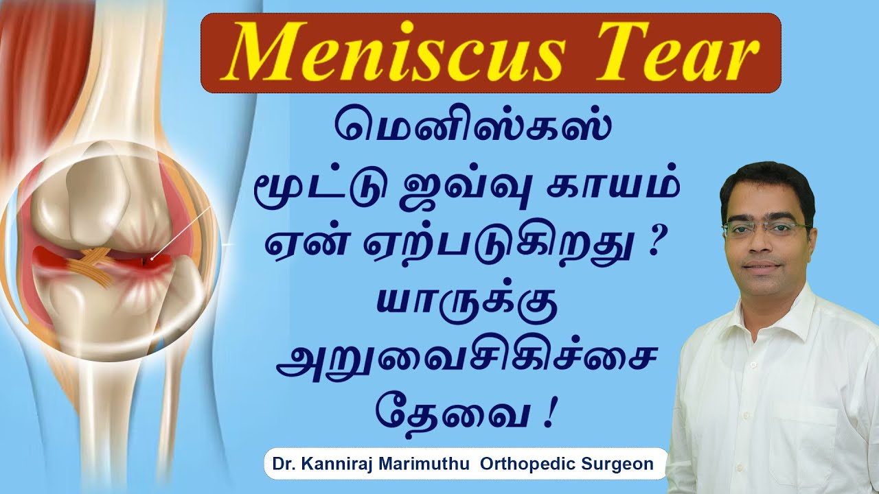 Meniscus Tear மெனிஸ்கஸ் மூட்டு ஜவ்வு காயம் ஏன் ஏற்படுகிறது ?யாருக்கு அறுவைசிகிச்சை தேவை ?