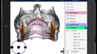 MedCAD Surgical Planning screenshot 2