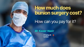 How much does bunion surgery cost? How can you pay for it?  👣   | Kaser Nazir